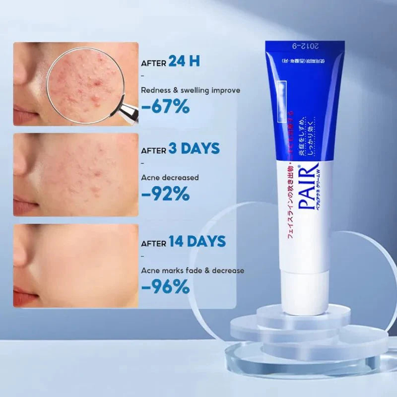 Lion- Pair Acne Cream W-14g