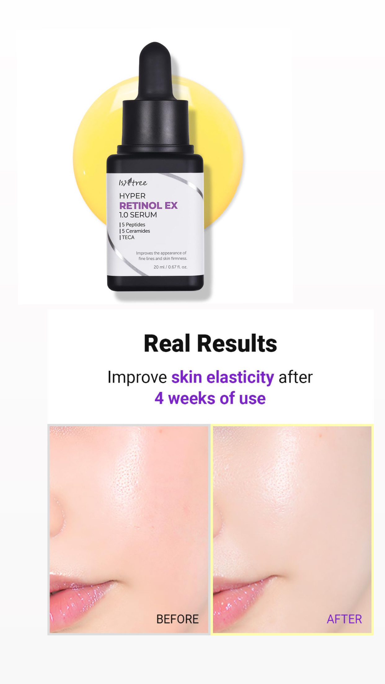 Isntree Hyper Retinol EX 1.0 Serum 20ml 
