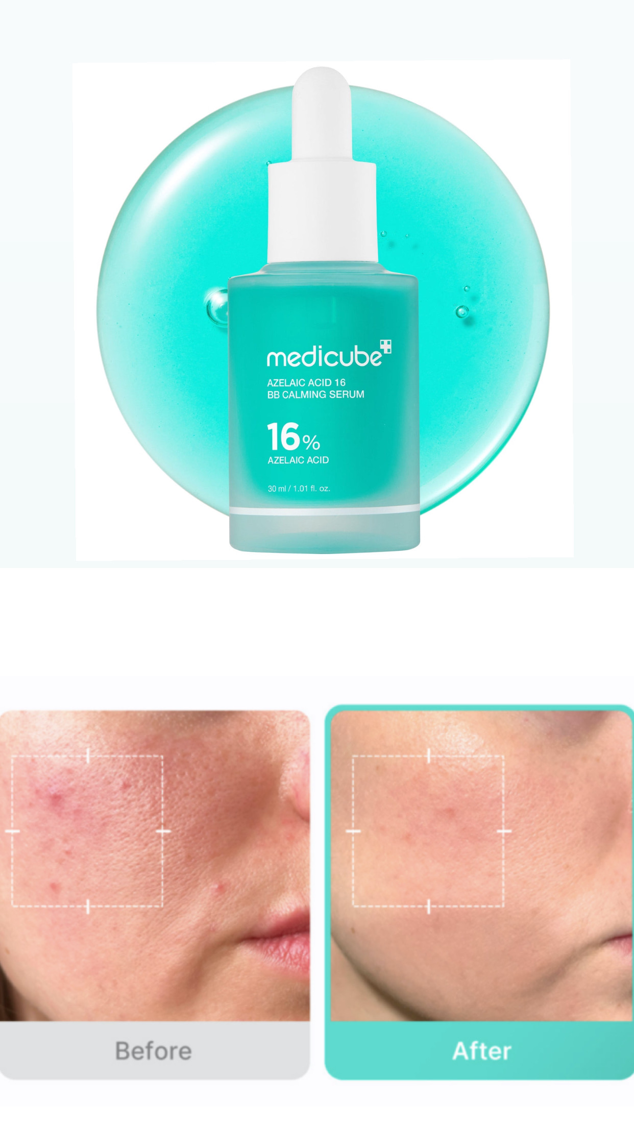 Medicube Azelaic Acid 16 Calming Serum-30ml
