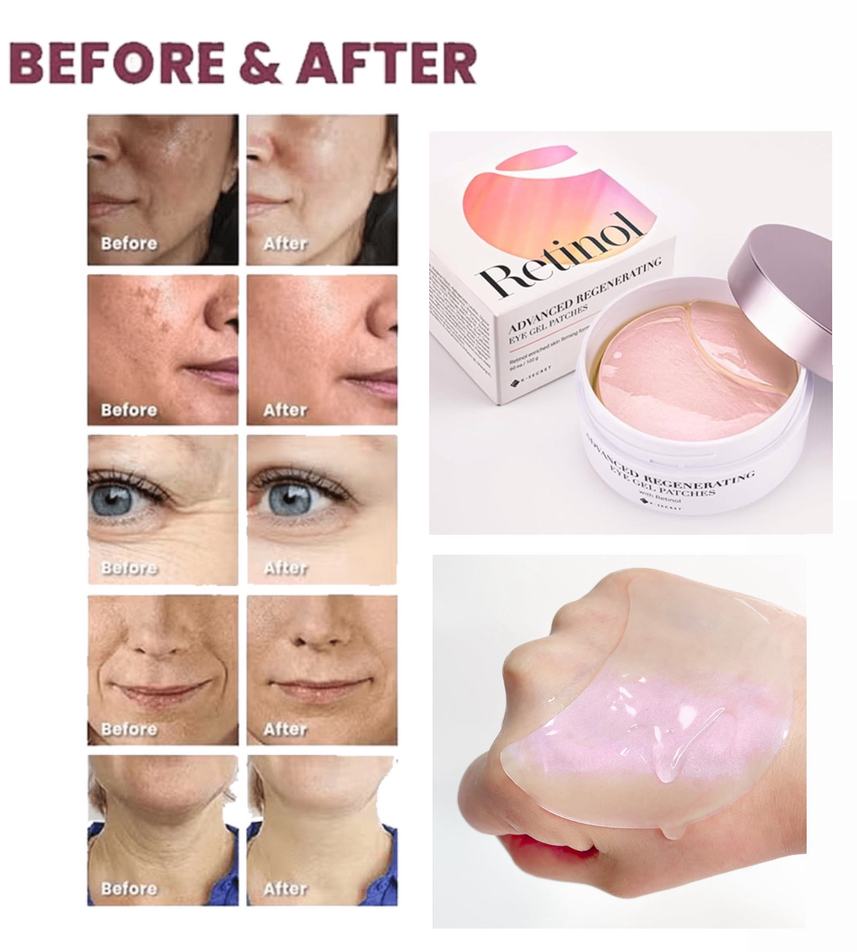 K secret-Advanced Regenerating Eye Gel Patches-60pcs
