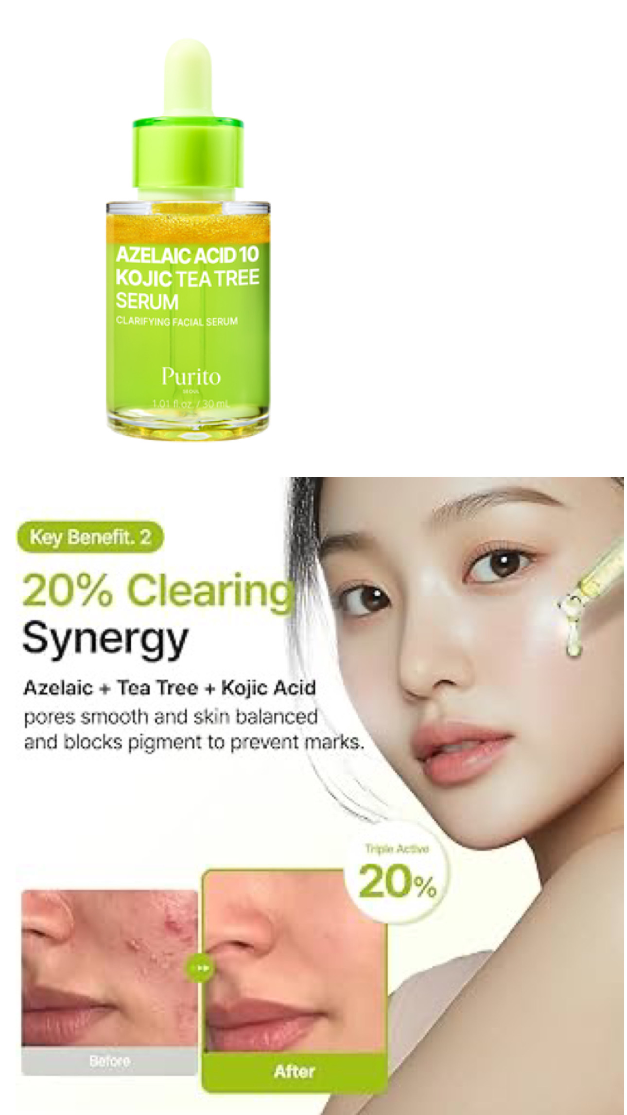 Purito SEOUL - Azelaic Acid 10 Kojic Tea Tree Serum-30ml
